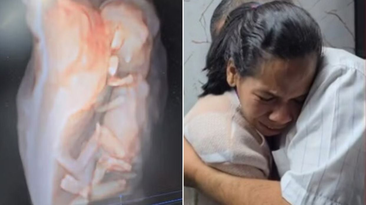 apos-laqueadura,-mulher-engravida-e-relata-milagre:-“deus-tem-um-proposito”