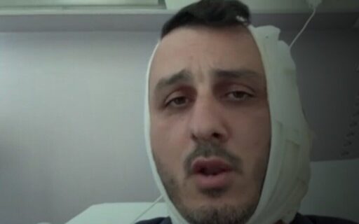 turista-israelense-tem-orelha-arrancada-na-grecia-por-homem-que-gritou:-“eu-sou-o-hamas”