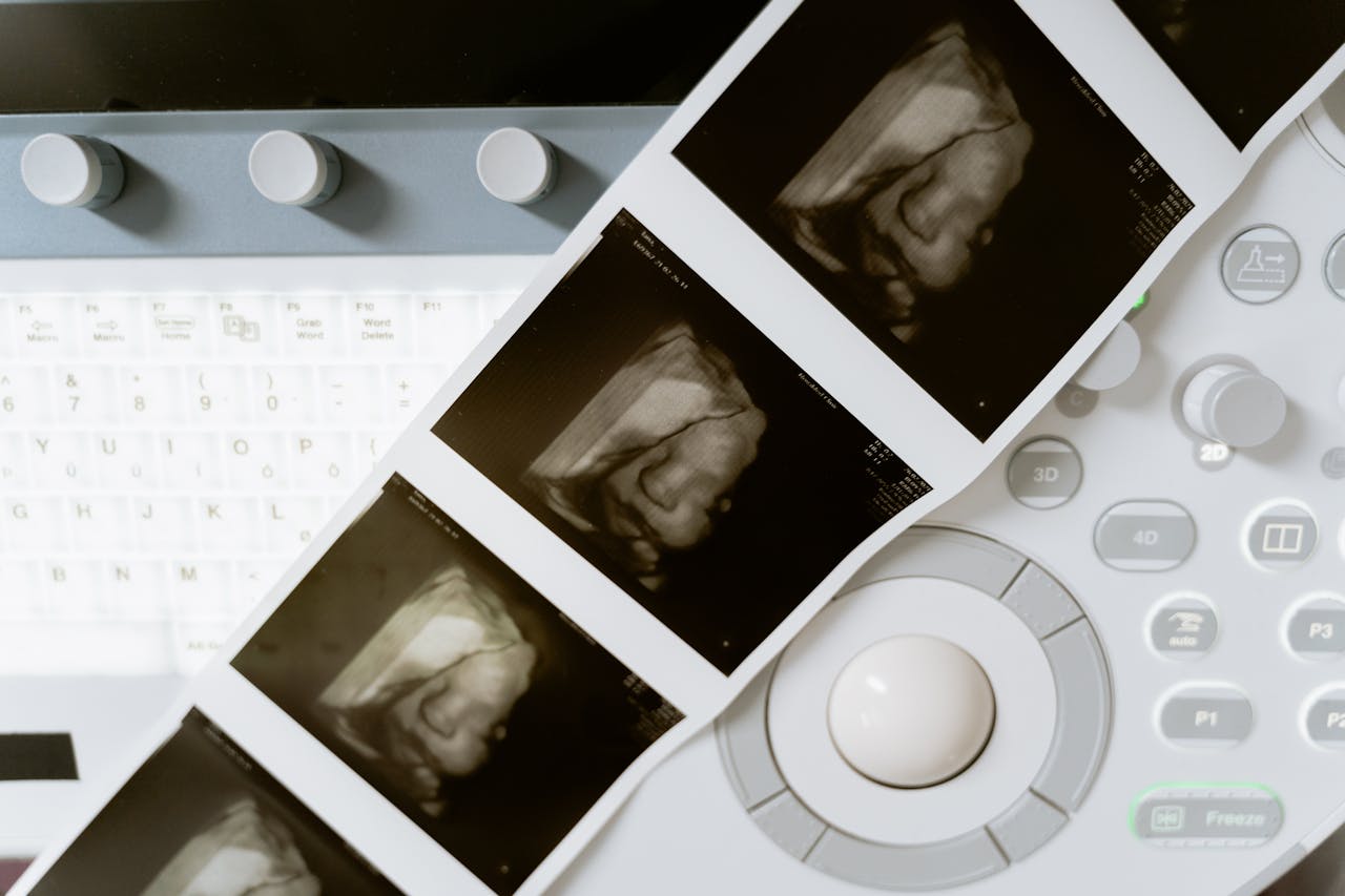 irlanda-registra-quase-11-mil-abortos-e-estabelece-novo-recorde-em-2024